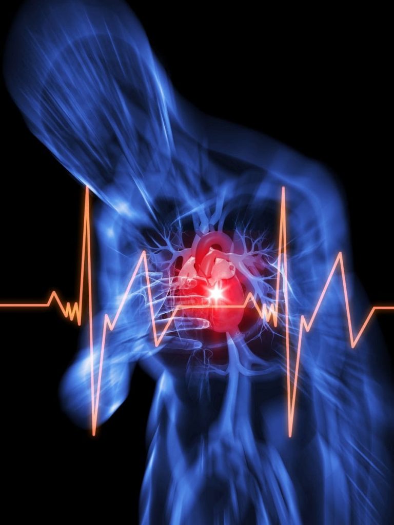 Cardiac Arrest Menjadi Faktor Kematian yang Utama